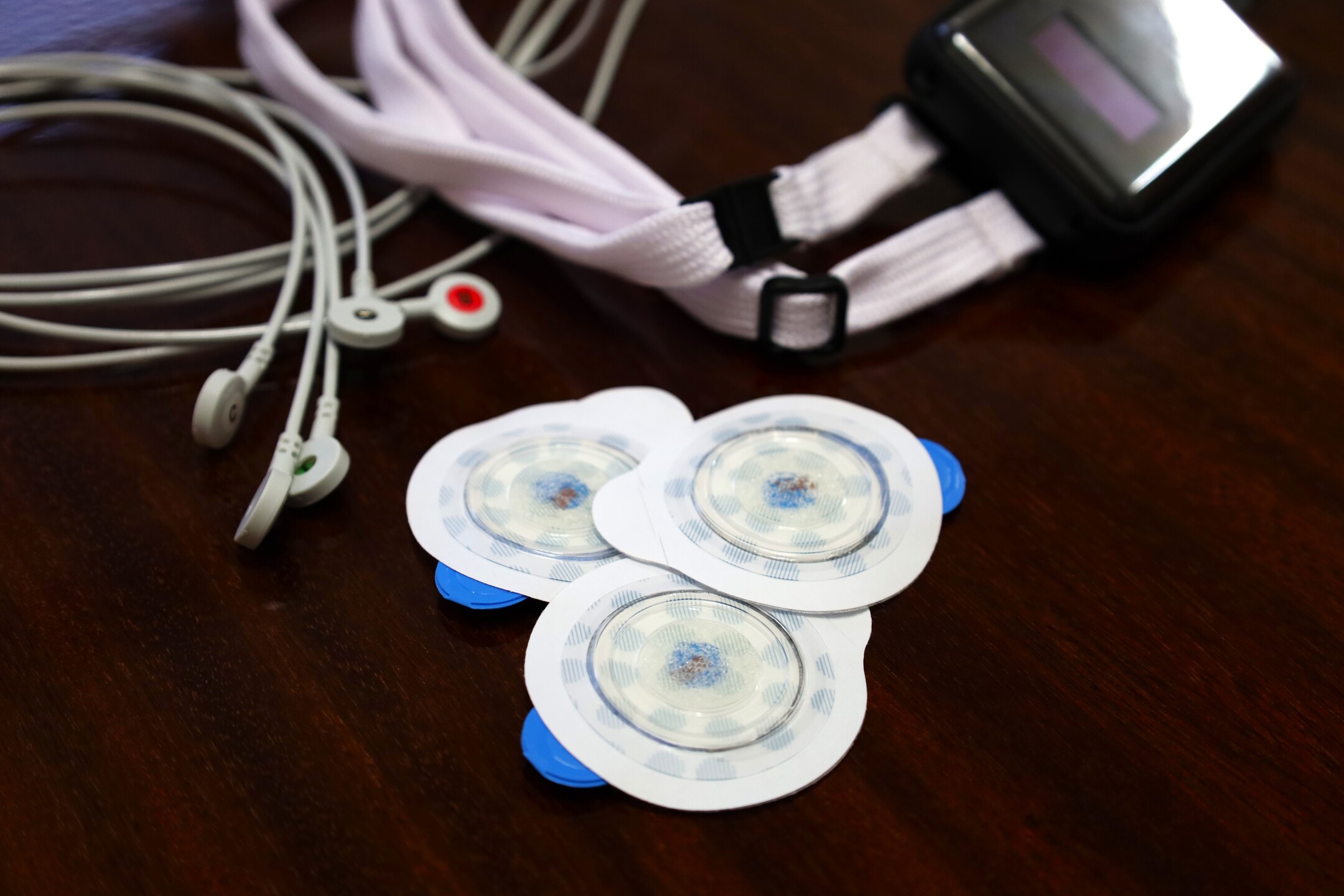 FNsP ZA Kontinuálne monitorovanie EKG počas hospitalizácie významne zvyšuje pravdepodobnosť odhalenia fibrilácie predsiení