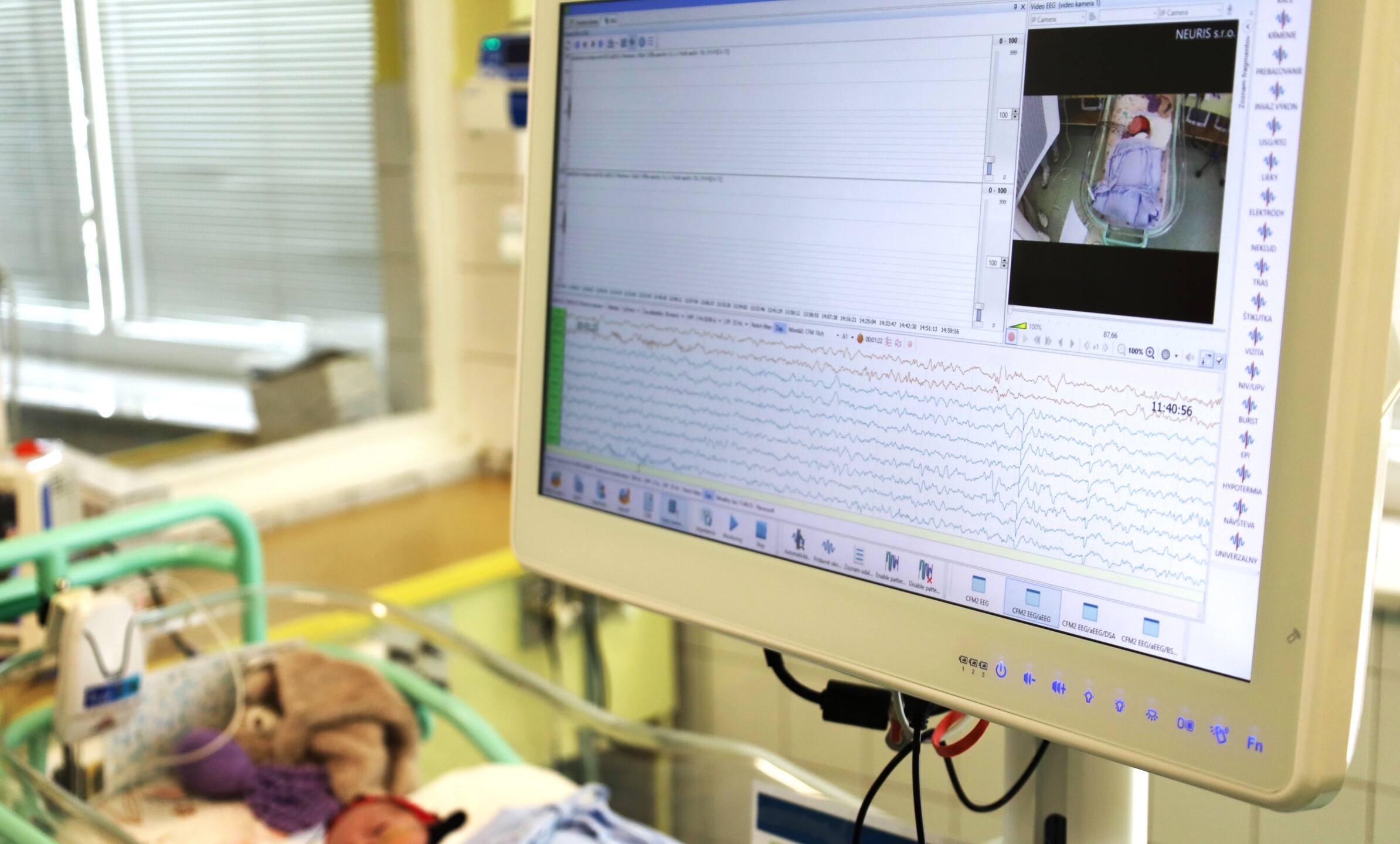 FNsP ZA Technológia je kľúčová pre diagnostiku liečbu a predvídanie neurologického vývoja predčasne narodených a rizikových detí