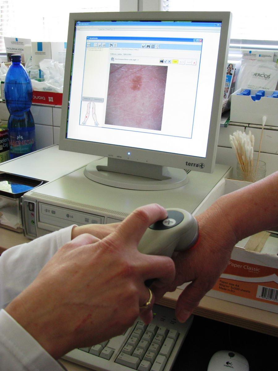1077 fnsp zaeuropsky den melanomu pripomina dolezitost prevencie a vcasneho vysetrenia materskych znamienok jpg