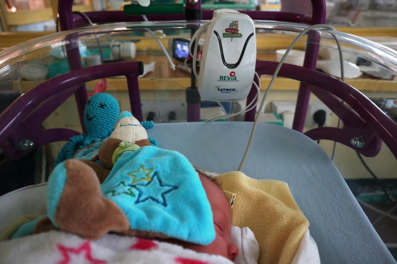 1979 fnsp zastarsie monitory dychu nahradili kvalitnejsie nove pristroje jpg