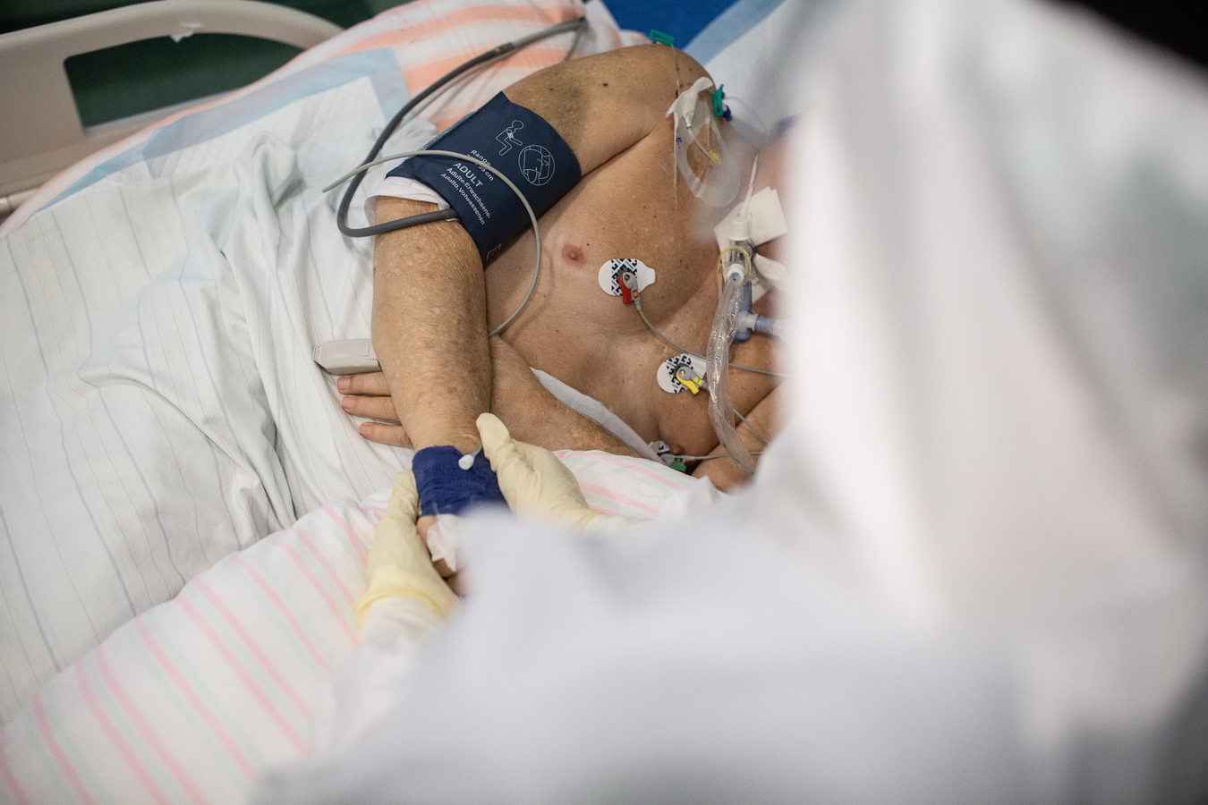 fnspza pacienti prichadzaju do nemocnic v uz kritickom stave